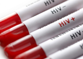 Už druhý pacient byl zbaven viru HIV